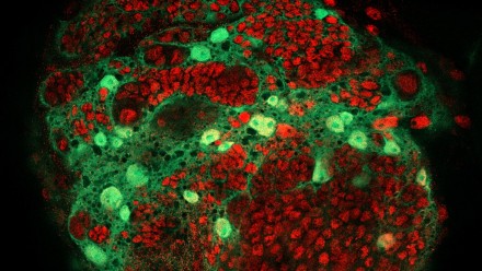 LSM800 image of Drosophila larval brain cells