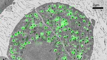 CLEM image of a grey cell with small green fluorescent molecules on it. It is a combination of an SEM image and a confocal image