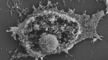 An Ultraplus FESEM image of rupturing immune cells