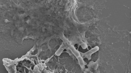 An immune cell, macrophage, expelling a rod-shaped bacteria