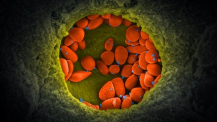 This SEM image shows a small colony of fossilised yeast cells (coloured orange). Almost all of the cells show bud and/or births scars (coloured blue). The fossils were found at McGraths Flat, a recently discovered fossil Lagerstätte near Gulgong (NSW)