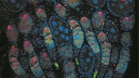 An LSM800 image of a Pupal Drosophila Ovar