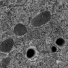 The SEM allows us to zoom in on the organelles of interest to display their ultrastructural features 