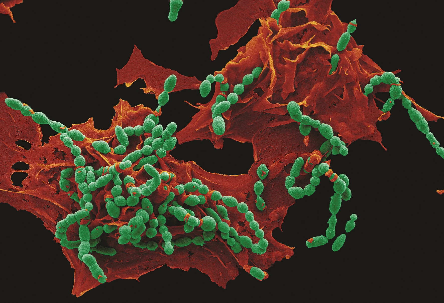 Can you count the number of bacterial spheres? by Anukriti Mathur. Can you count the number of bacterial spheres? by Anukriti Mathur.