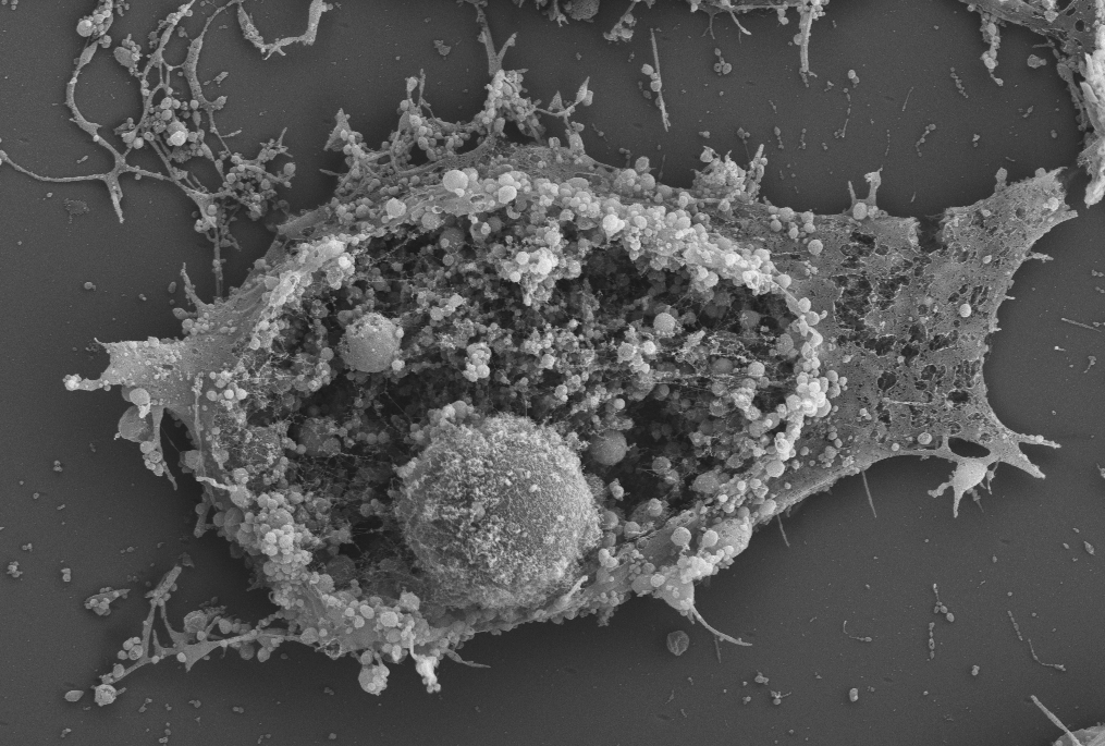 Cell explosion imaged on ZEISS UltraPlus SEM