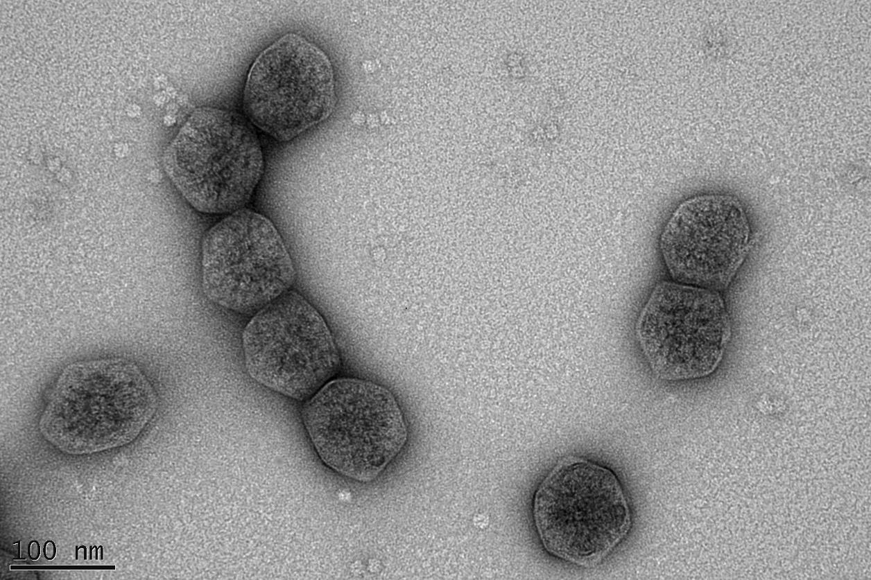 Carboxysome