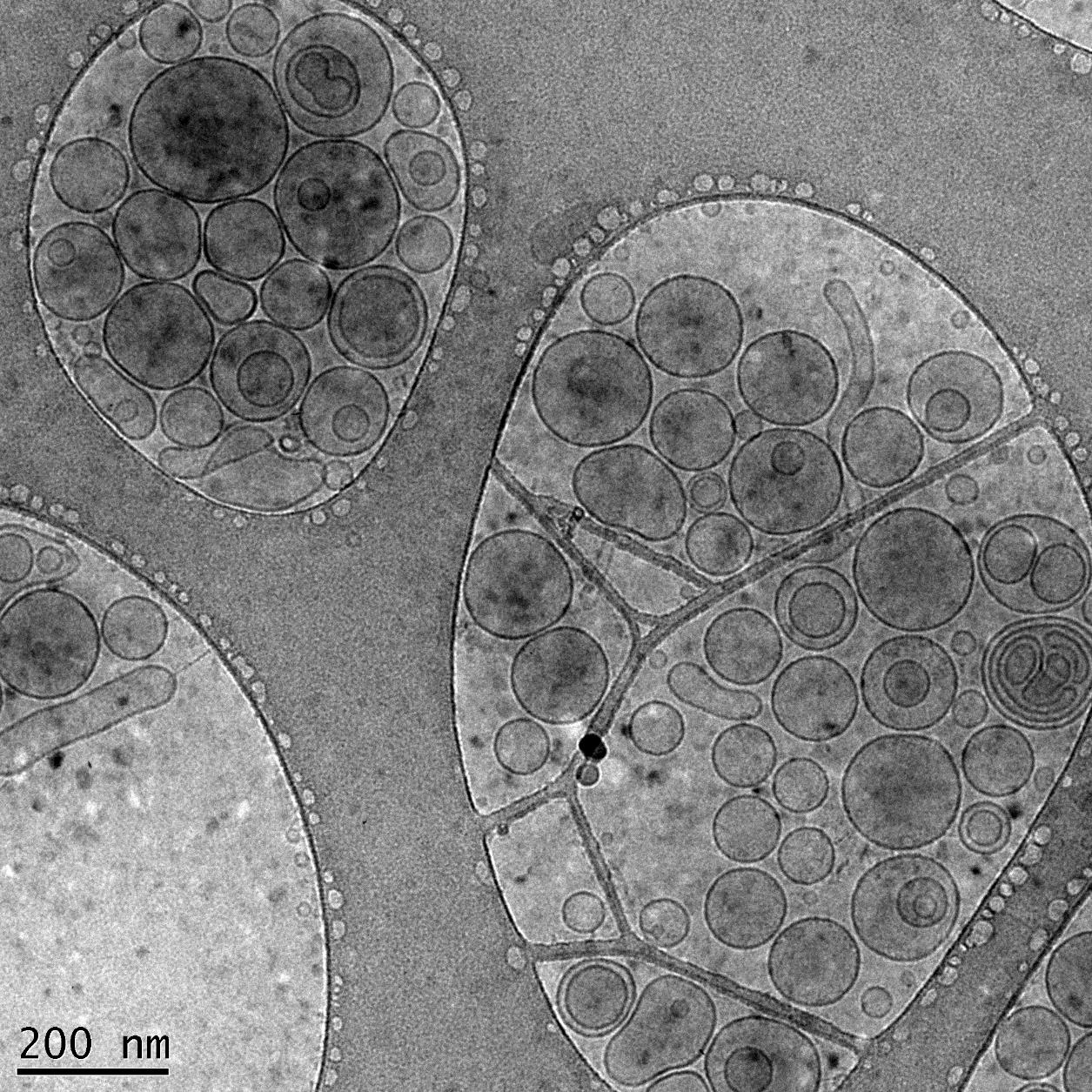 Liposomes