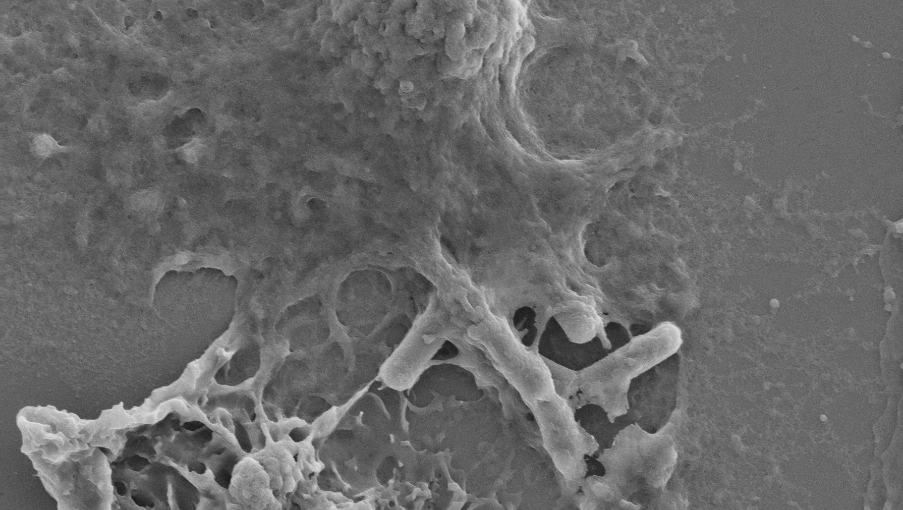An immune cell, macrophage, expelling a rod-shaped bacteria An immune cell, macrophage, expelling a rod-shaped bacteria