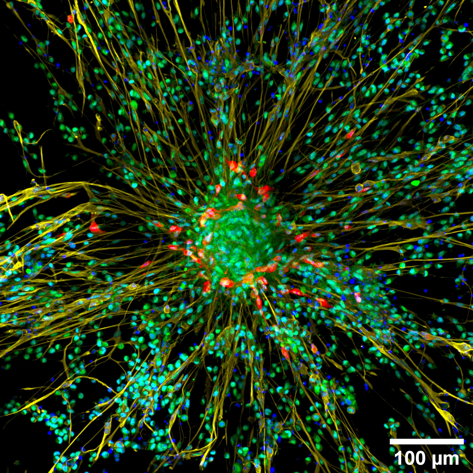 Image of neurons under ZEISS LSM800 microscope