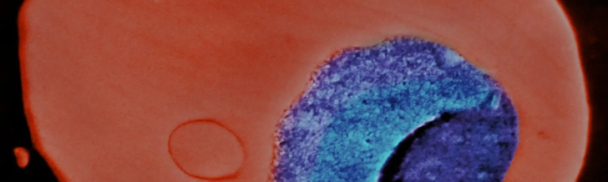 RBC plasmodium
