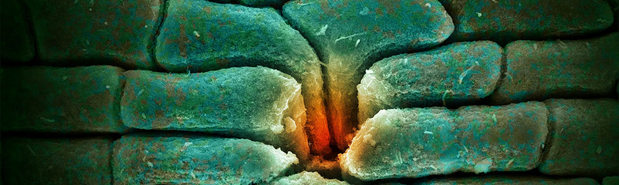 SEM image of the epidermis of a 15-million-year-old leaf