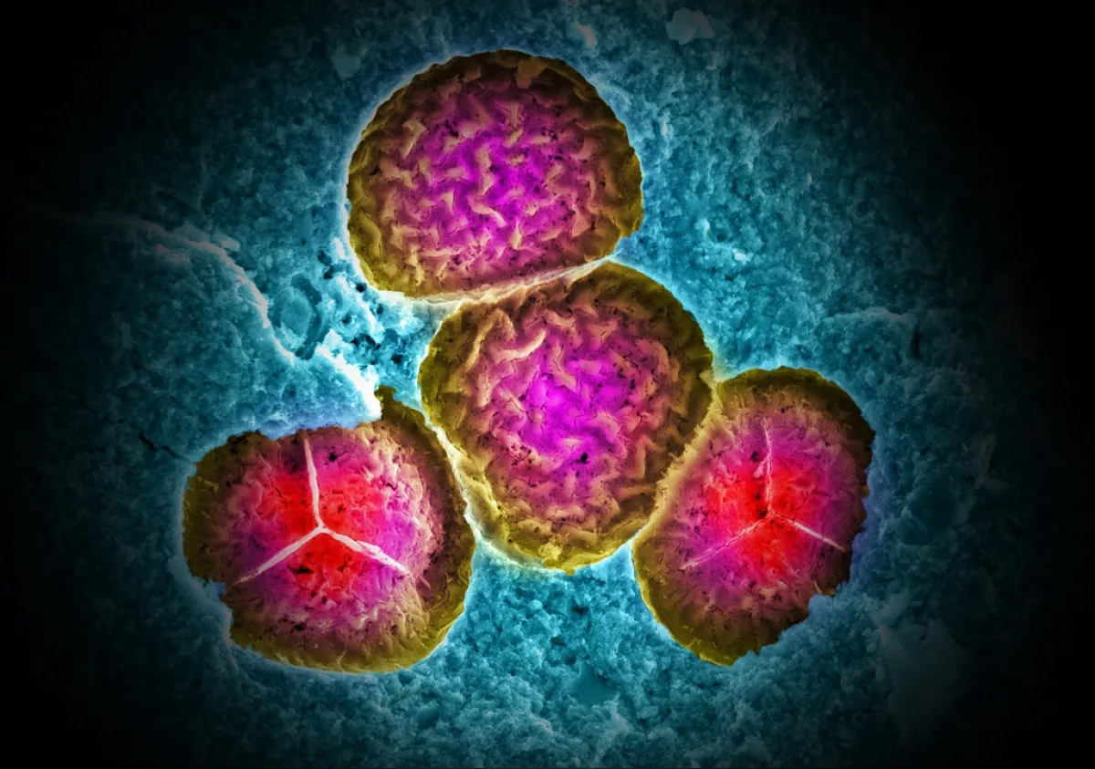 The SEM image shows a fossilised 'tetrad' of 4 liverwort spores (Cingulasporites ornatus) from McGraths Flat, a newly discovered fossil site near Gulgong, NSW. The depicted pollen helped to date the fossil site as a ca. 15 million-year-old Miocene deposit