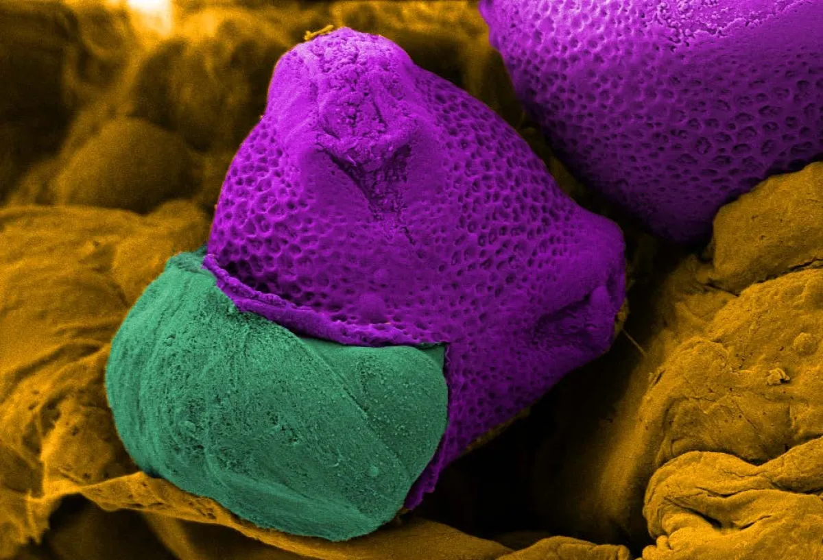 SEM image of a chickpea pollen cell