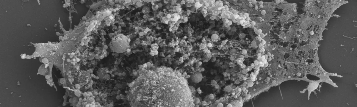 Cell explosion imaged on ZEISS UltraPlus SEM