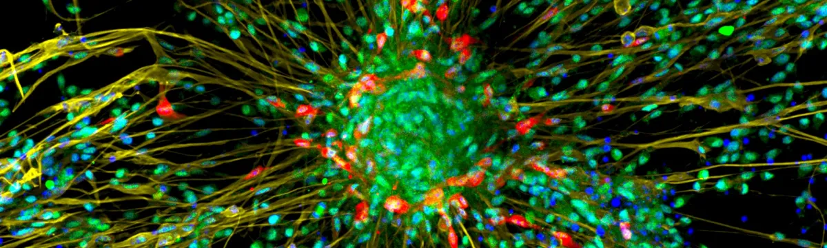 Image of neurons under ZEISS LSM800 microscope