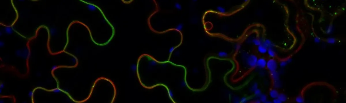 Rainbow puzzles in planta BDagvadorj