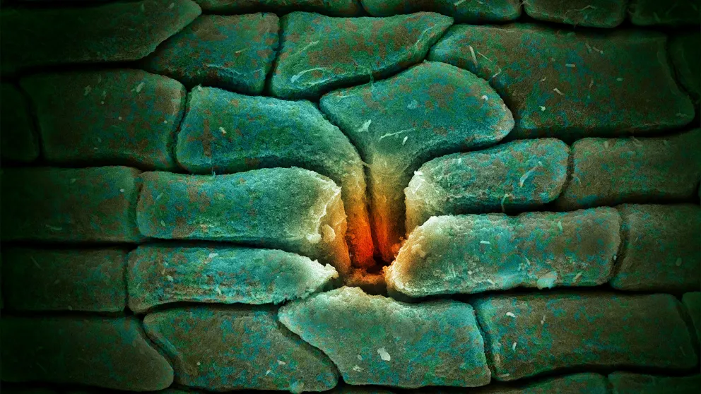 SEM image of the epidermis of a 15-million-year-old leaf