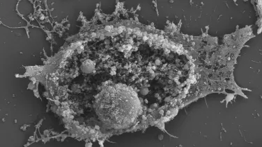 Cell explosion imaged on ZEISS UltraPlus SEM