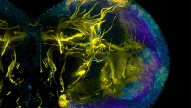 Lightning flash, deep in the brain. Image by Nan-hee Kim, ZEISS LSM800 with Airyscan.