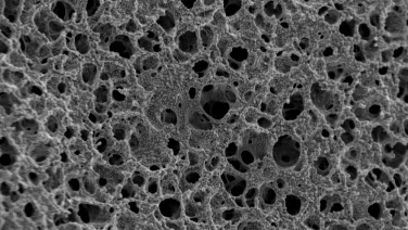 SEM image of mesoporous hydrogel