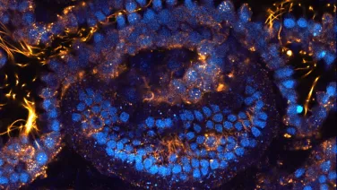 Image taken on ZEISS LSM800 microscope